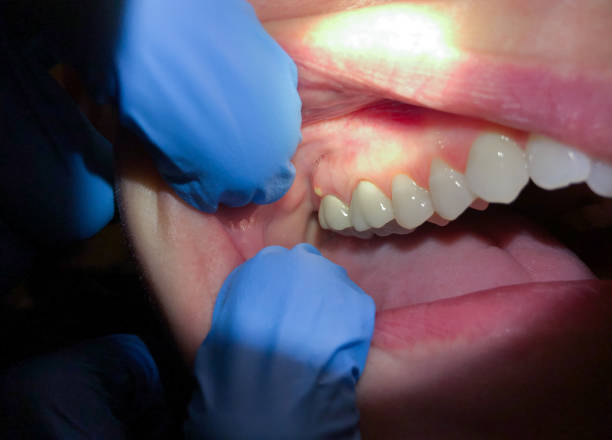Best Emergency Tooth Extraction in Masontown, PA