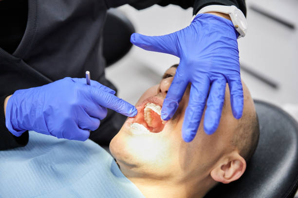 Best Urgent Care for Lost Fillings or Crowns in Masontown, PA